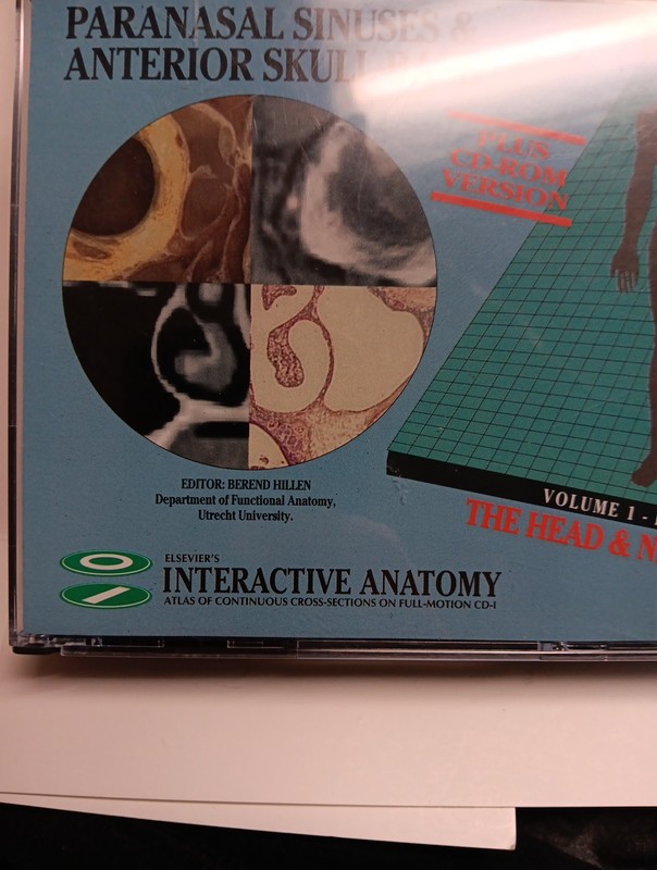 Paranasal Sinuses Anterior Skull Base Elsevier's Cd-i Interactive CD-ROM EXCELLE gallery