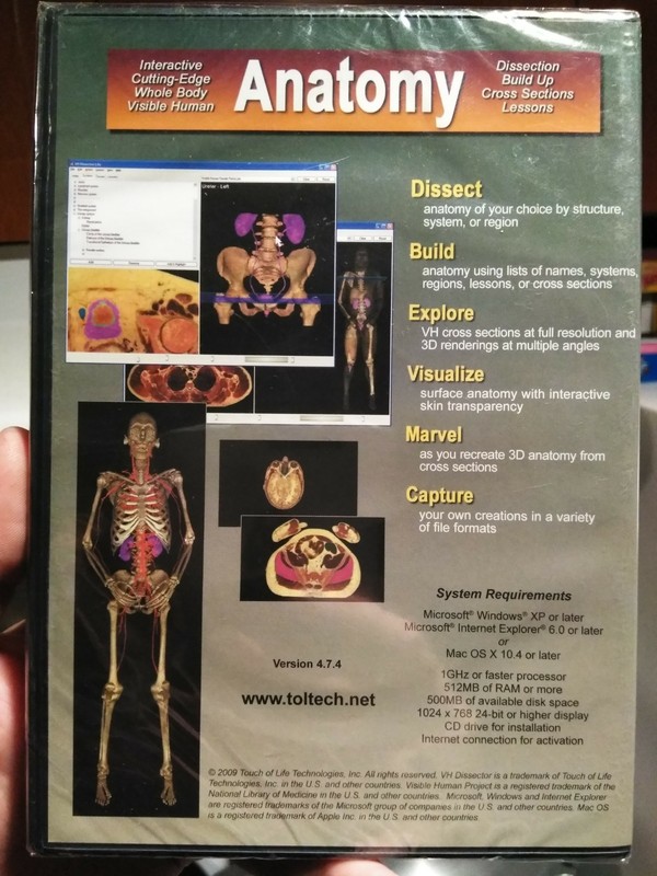 VH DISSECTOR LITE - Male & Female Anatomy (Software CD for PC/MAC, 2009) gallery